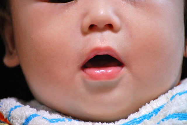 こどもに多い、上唇小帯付着異常とは