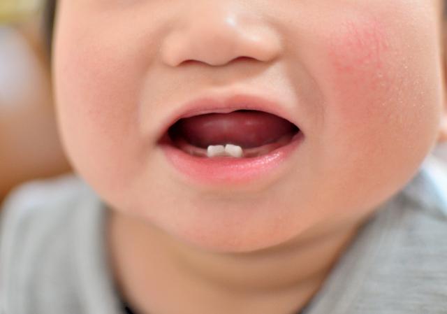 どうする？子どもの定期検診！予防歯科のすすめ