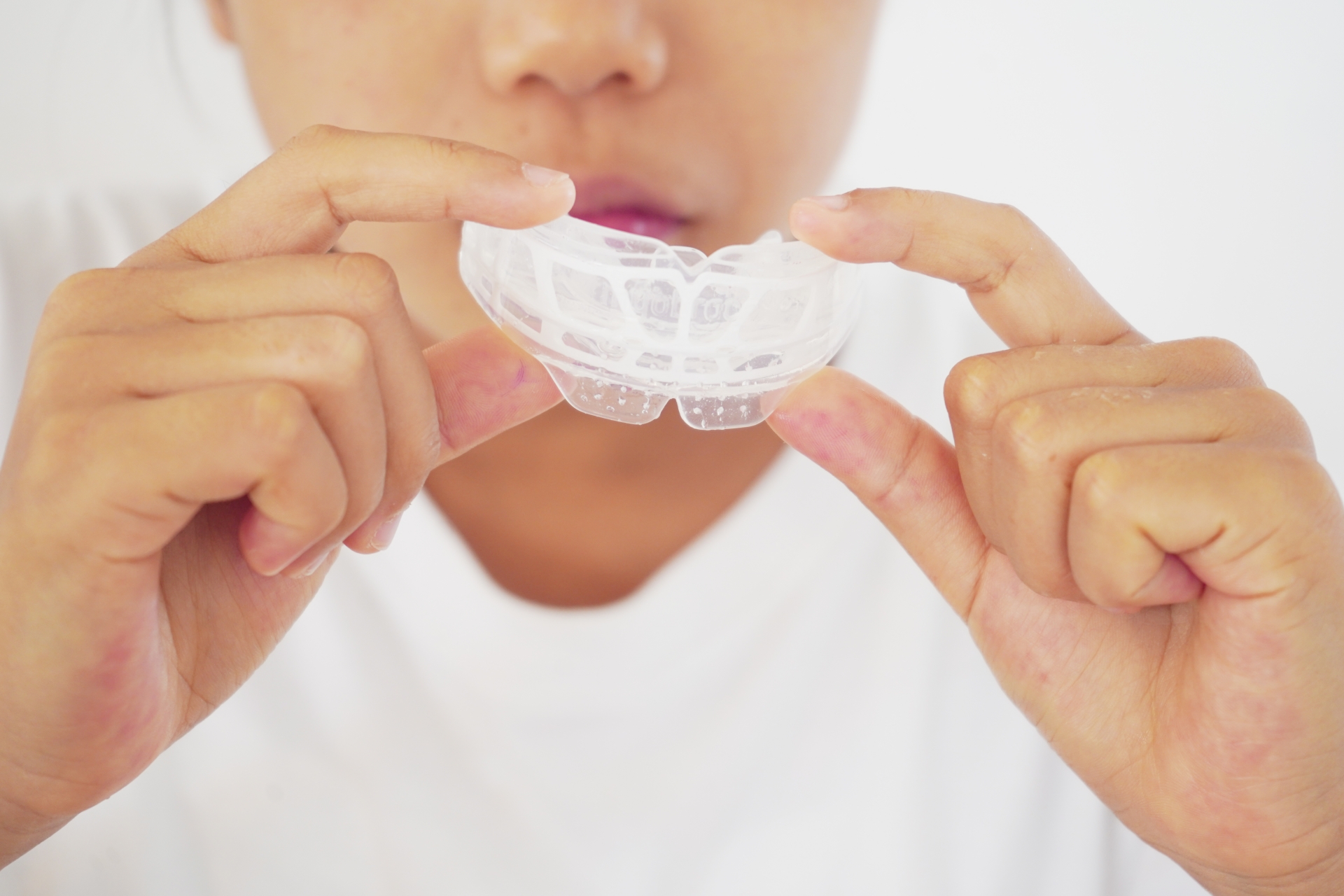 子供でもマウスピース矯正はできる？